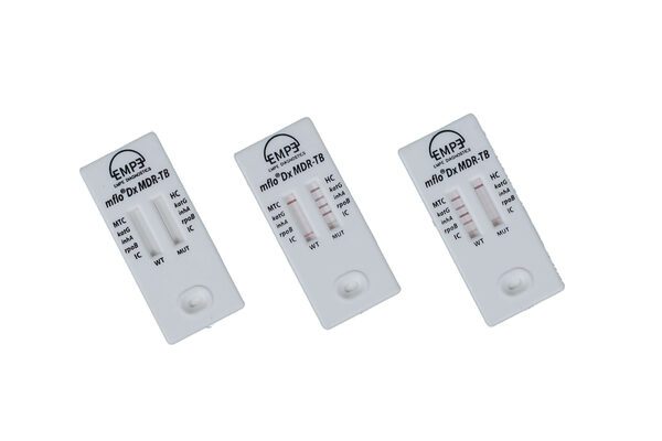 TB diagnostic test strips for laboratory sample testing